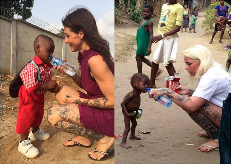 ”لوفن” الدانماركية تنقذ ”أمل” الطفل النيجيري 