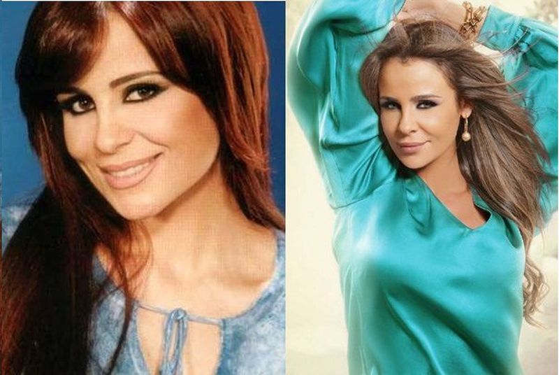 5 فنانات ندمن على إجرائهن عمليات التجميل 5 فنانات ندمن على إجرائهن عمليات التجميل