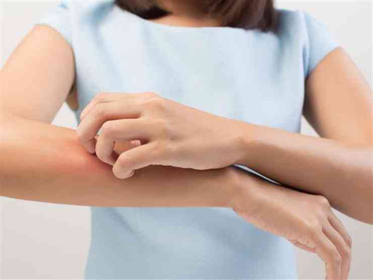 أسباب حساسية الجسم المفاجئة وعلاجها أسباب حساسية الجسم المفاجئة وعلاجها