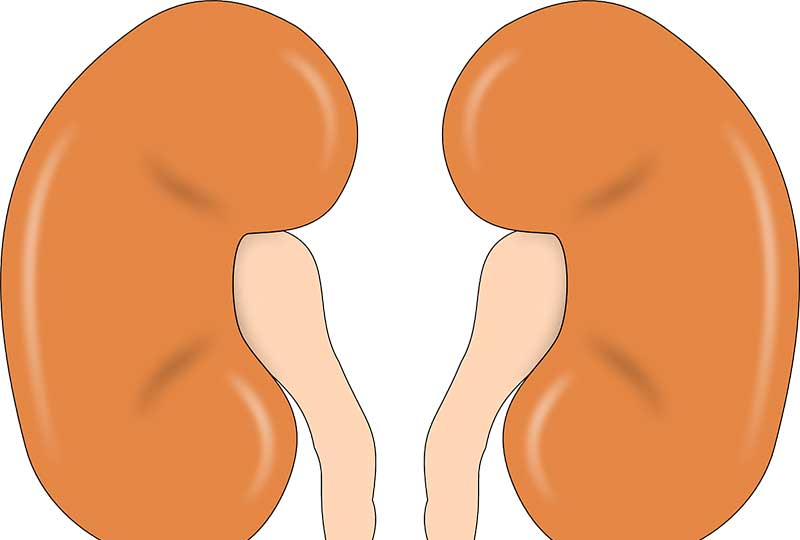 أعراض مرض الفشل الكلوي وأسبابه